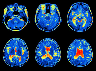 Brain function assessment tools